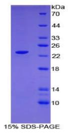 SDS-PAGE (CLEC10A-1856H).jpg